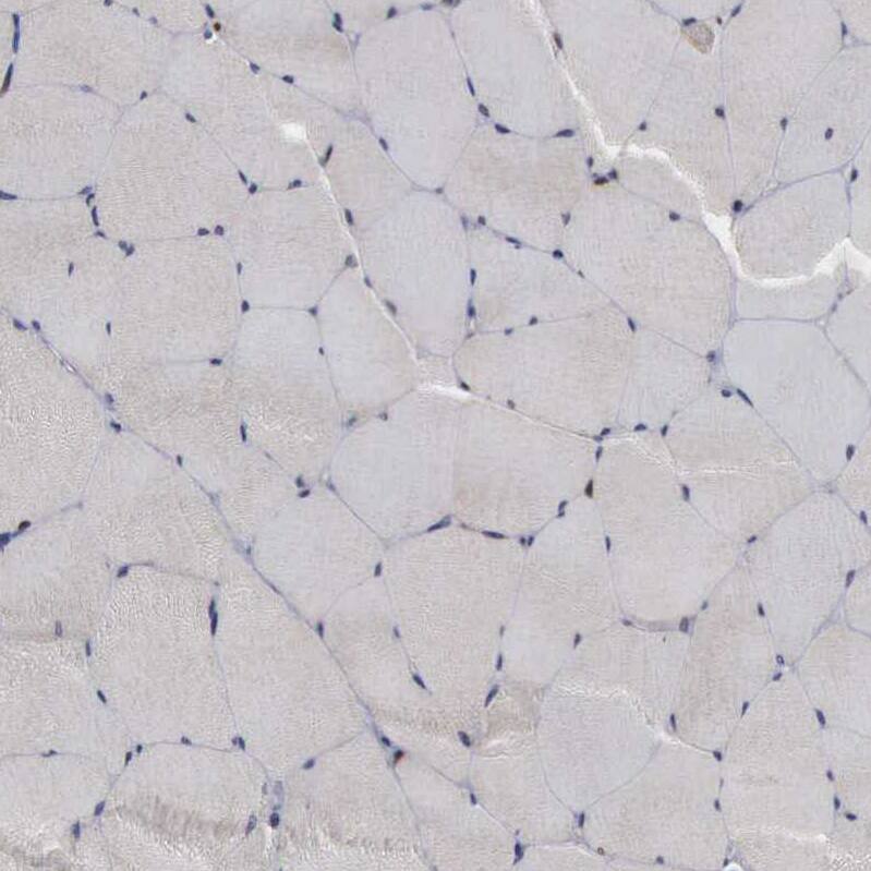 Staining of human skeletal muscle shows no positivity in myocytes as expected.