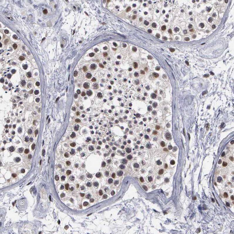 Staining of human testis shows strong nuclear positivity in cells in seminiferous ducts.