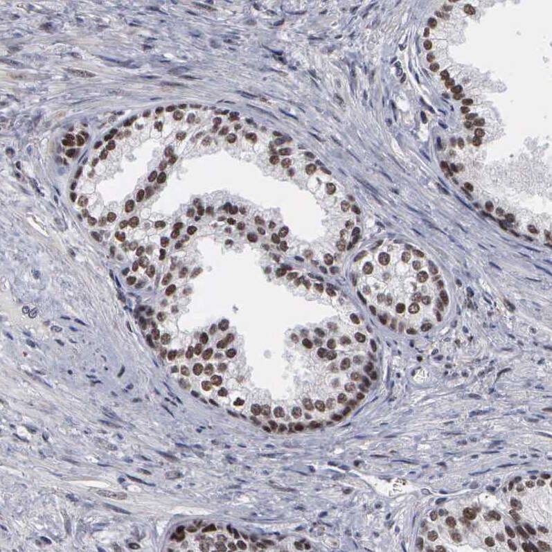 Staining of human prostate shows strong nuclear positivity in glandular cells.