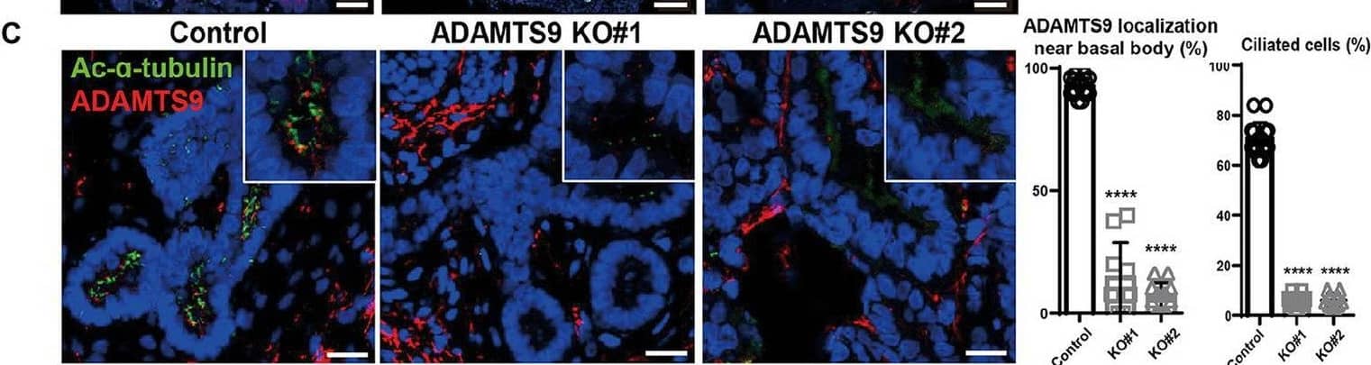 ADAMTS9 knockout kidney organoids demonstrate abnormal cilia, and ciliogenesis is not rescued by overexpressing ADAMTS9 variants. (A) ADAMTS9 is localized near the basal bodies of primary cilia and co-localized with PCM-1. The organoids were stained with anti-ADAMTS9, anti-Ac-alpha -tubulin, anti-PCM1, or anti-gamma -tubulin antibodies. Scale bar, 10 μm. (B) Immunofluorescence staining of the kidney organoids displaying different structures, including the glomerulus (NEPHRIN), proximal tubules (LTL), and distal tubules (ECAD). Scale bar, 100 μm. (C) Loss or shortening of primary cilia was observed in ADAMTS9 knockout organoids. Percentage of ciliated tubular cells in kidney organoids and quantification of cilium length on the basis of Ac-alpha -tubulin staining are shown in the right panel. Data represent means +/- standard deviation (SD). Scale bar, 10 μm. ****p < 0.0001. (D) Ciliogenesis was rescued by overexpressing wild-type but not by mutant forms of ADAMTS9, in ADAMTS9-ablated kidney organoids. Scale bar, 10 μm. Image collected and cropped by CiteAb from the following open publication (//pubmed.ncbi.nlm.nih.gov/37035301), licensed under a CC-BY license. Not internally tested by Novus Biologicals.