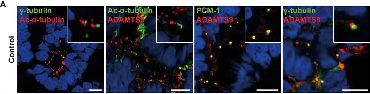 ADAMTS9 knockout kidney organoids demonstrate abnormal cilia, and ciliogenesis is not rescued by overexpressing ADAMTS9 variants. (A) ADAMTS9 is localized near the basal bodies of primary cilia and co-localized with PCM-1. The organoids were stained with anti-ADAMTS9, anti-Ac-alpha -tubulin, anti-PCM1, or anti-gamma -tubulin antibodies. Scale bar, 10 μm. (B) Immunofluorescence staining of the kidney organoids displaying different structures, including the glomerulus (NEPHRIN), proximal tubules (LTL), and distal tubules (ECAD). Scale bar, 100 μm. (C) Loss or shortening of primary cilia was observed in ADAMTS9 knockout organoids. Percentage of ciliated tubular cells in kidney organoids and quantification of cilium length on the basis of Ac-alpha -tubulin staining are shown in the right panel. Data represent means +/- standard deviation (SD). Scale bar, 10 μm. ****p < 0.0001. (D) Ciliogenesis was rescued by overexpressing wild-type but not by mutant forms of ADAMTS9, in ADAMTS9-ablated kidney organoids. Scale bar, 10 μm. Image collected and cropped by CiteAb from the following open publication (//pubmed.ncbi.nlm.nih.gov/37035301), licensed under a CC-BY license. Not internally tested by Novus Biologicals.