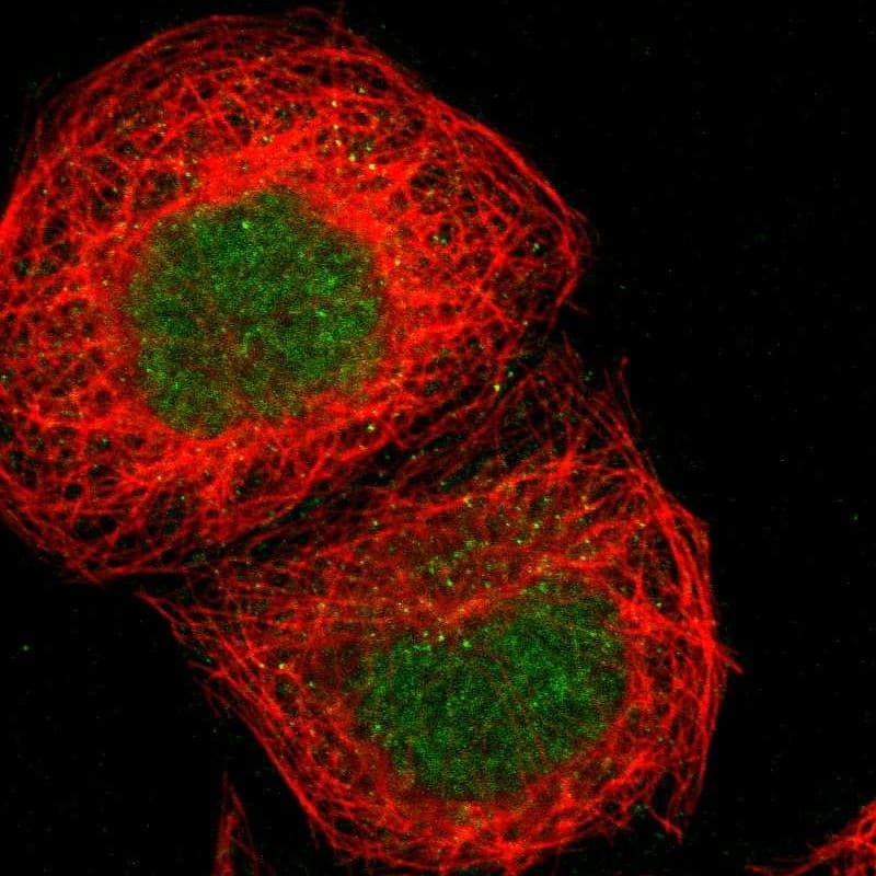 Immunocytochemistry/ Immunofluorescence ZNF777 Antibody - BSA Free