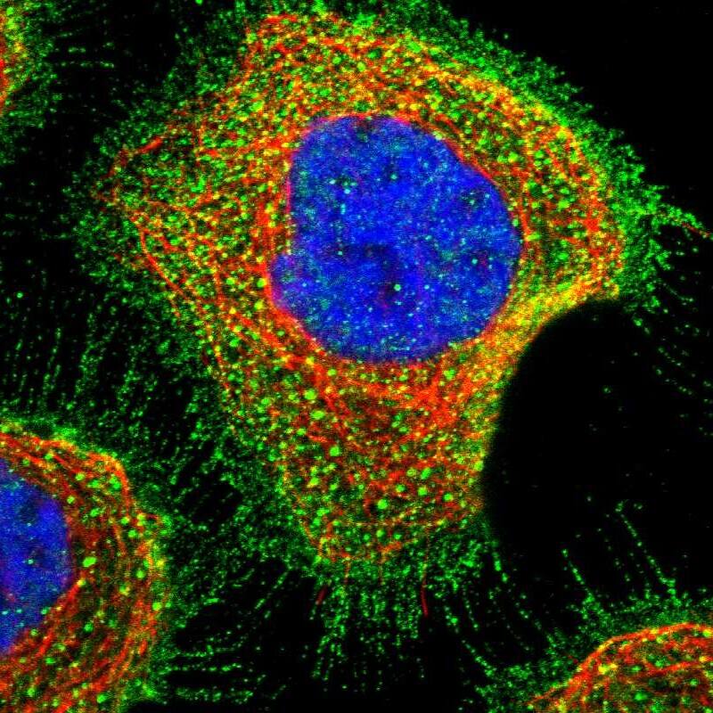 Staining of human cell line A-431 shows localization to plasma membrane.