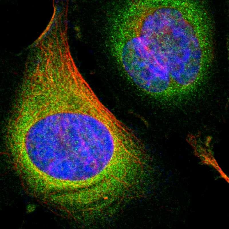 Staining of human cell line U-2 OS shows localization to cytosol.
