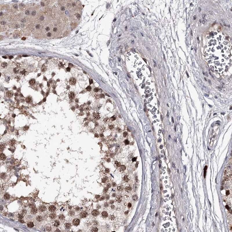 Staining of human testis shows moderate nuclear positivity in cells in seminiferus ducts.