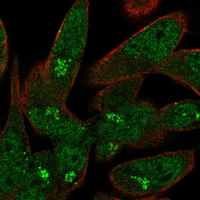 Staining of human cell line RH-30 shows localization to nucleoplasm & the Golgi apparatus.