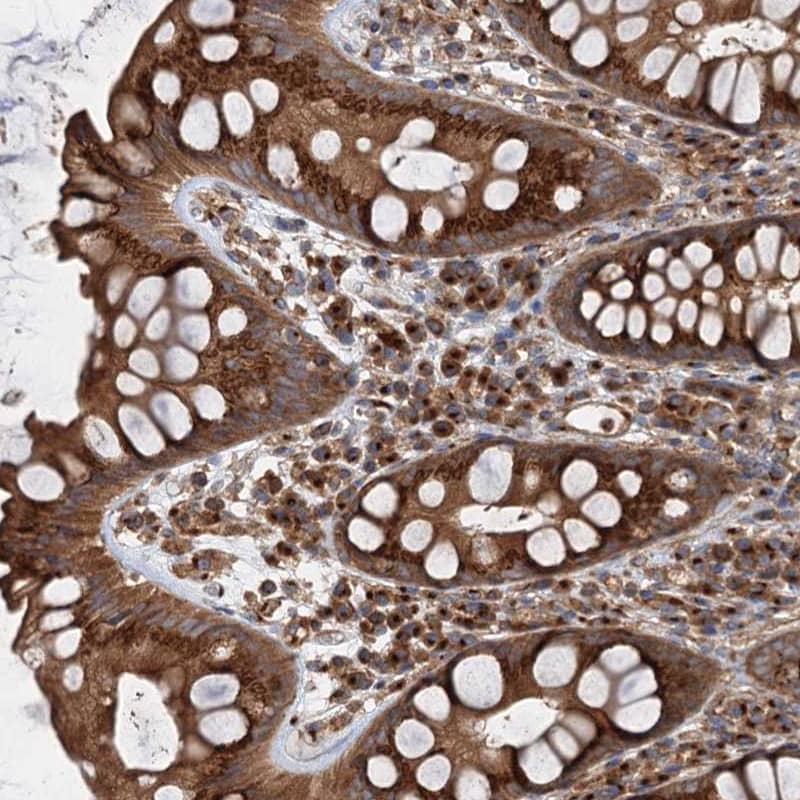 Immunohistochemistry-Paraffin ANKRD26 Antibody - BSA Free