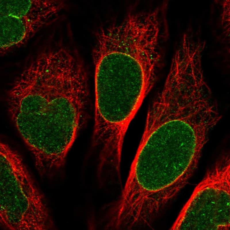 Immunocytochemistry/ Immunofluorescence NUP155 Antibody - BSA Free