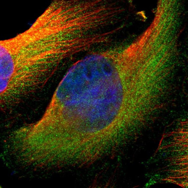 Staining of human cell line U-251 MG shows localization to cytosol.
