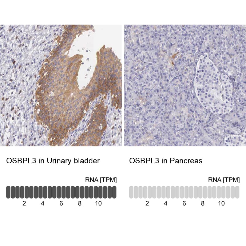 Immunohistochemistry-Paraffin OSBPL3 Antibody - BSA Free