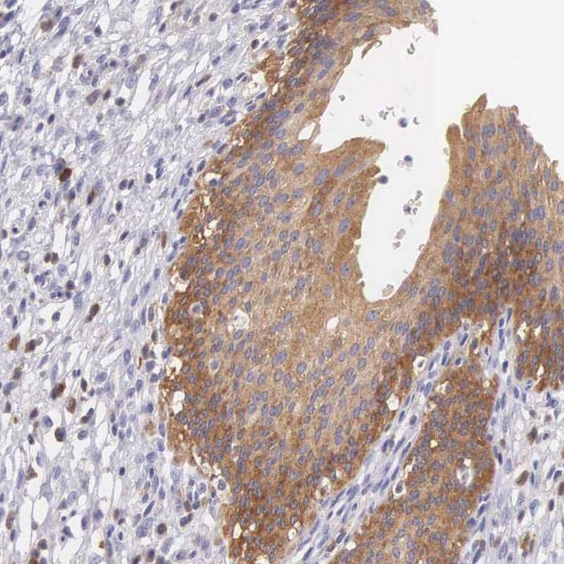 Staining of human urinary bladder shows high expression.