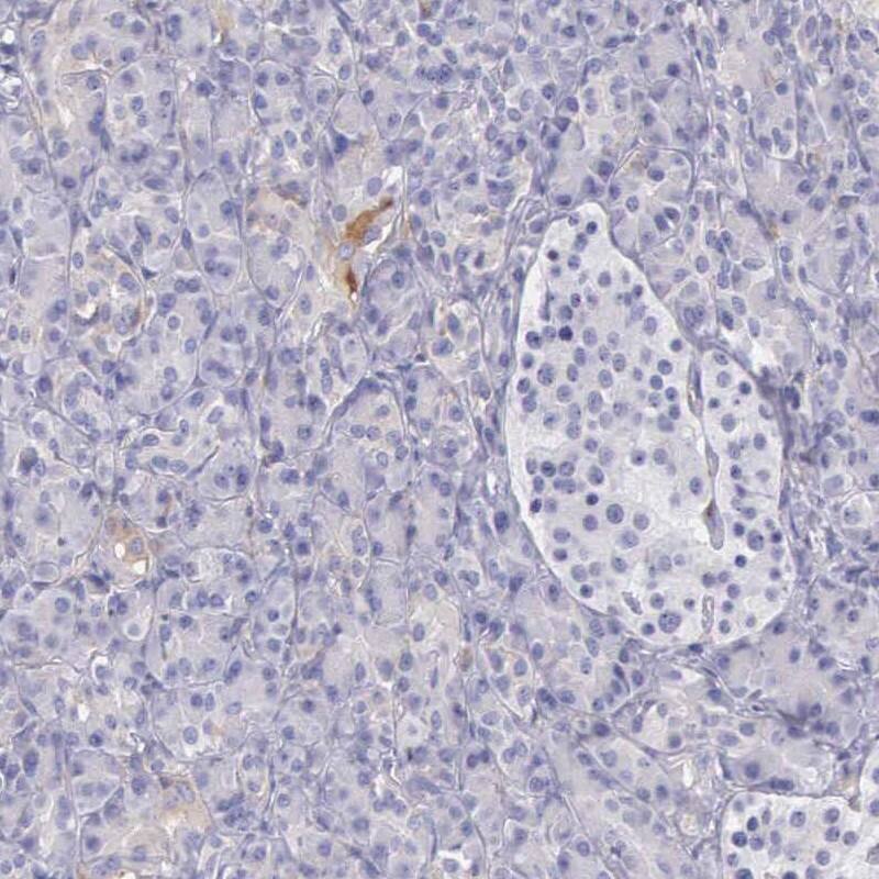 Staining of human pancreas shows low expression as expected.