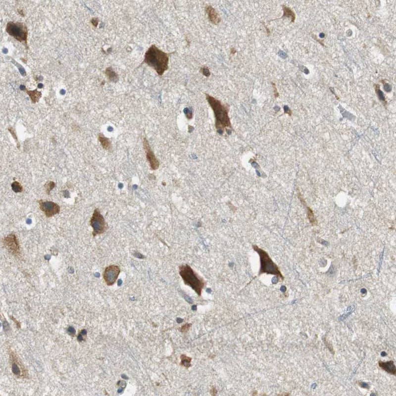 Staining of human cerebral cortex shows strong cytoplasmic positivity in neuronal cells.
