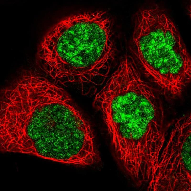 Staining of human cell line A-431 shows localization to nuclear speckles.