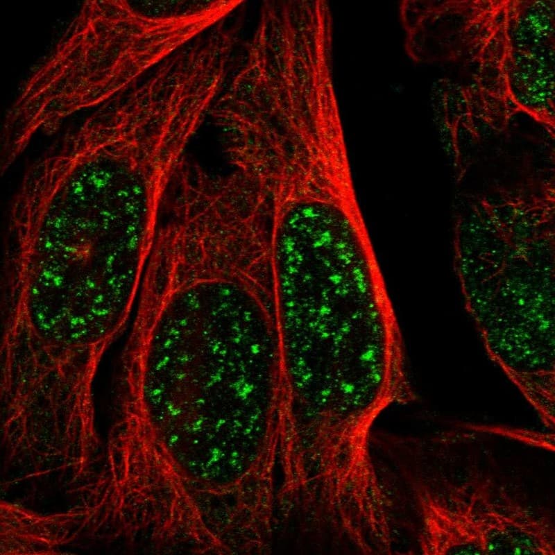 Immunocytochemistry/ Immunofluorescence MAST3 Antibody - BSA Free