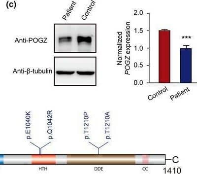 POGZ (GenBank accession number: NM_015100.4) de novo missense variants in neuropsychiatric disorders. (a) Frontal and lateral face photos of the proband reported in this study. (b) Sanger sequencing validated the missense variant is de novo. (c) Immunoblot analysis of POGZ expression in peripheral blood lymphocytes of patient and control. Three independent experiments were performed. Data are means +/- SEM. Differences were statistically significant by Student's t‐test (***p < .001). (d) Location distribution of all reported POGZ de novo missense variants. The novel de novo missense variant identified in this study is marked with red color. (e) Conservation analysis of all reported POGZ de novo missense. The new pathogenic de novo missense variant identified in our study is denoted in red color Image collected and cropped by CiteAb from the following open publication (//pubmed.ncbi.nlm.nih.gov/31347273), licensed under a CC-BY license. Not internally tested by Novus Biologicals.
