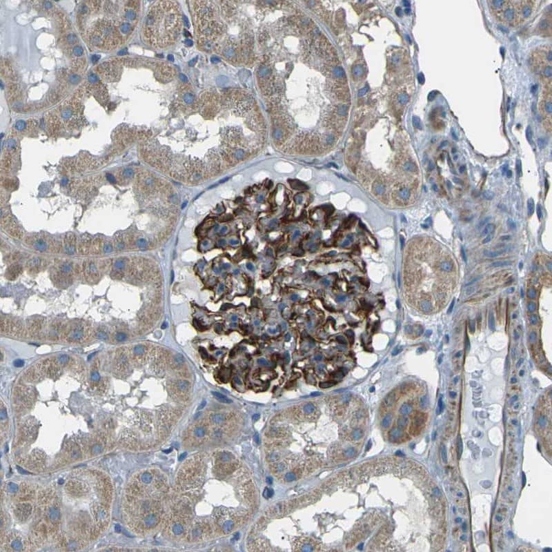 Staining of human kidney shows cytoplasmic and membranous positivity in glomeruli.