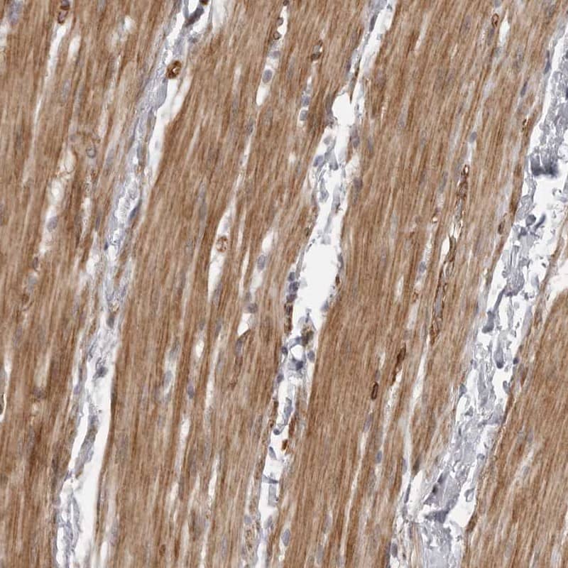 Staining of human smooth muscle shows distinct cytoplasmic positivity.
