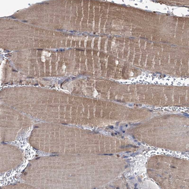 Staining of human skeletal muscle shows moderate cytoplasmic positivity in myocytes.