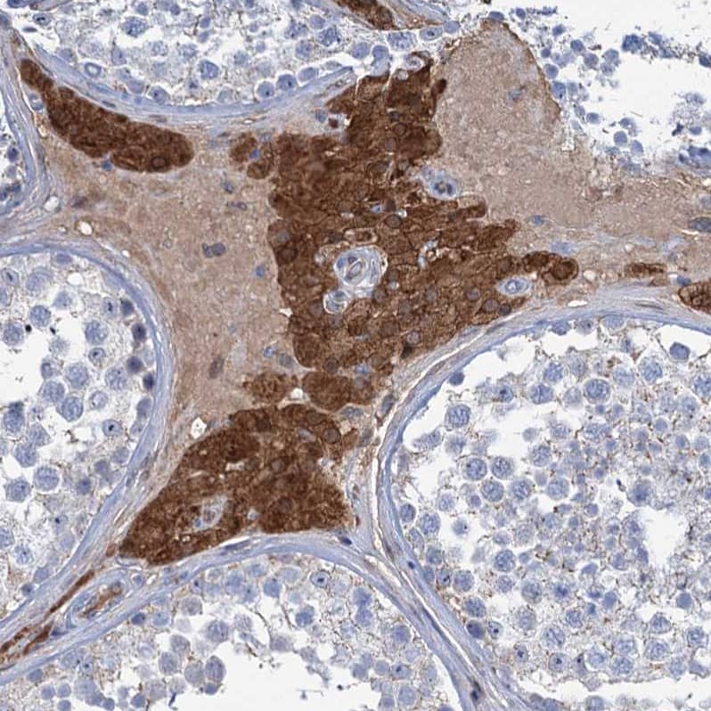 Staining of human testis shows strong cytoplasmic positivity in Leydig cells.