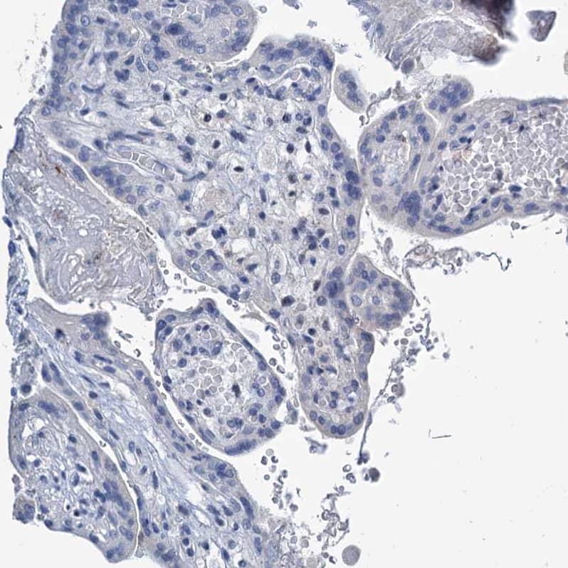 Staining of human placenta shows no positivity in trophoblastic cells as expected.