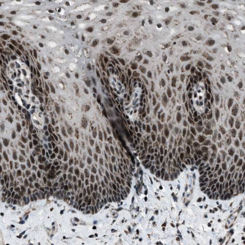 Staining of human esophagus shows nuclear and cytoplasmic positivity in squamous epithelial cells.