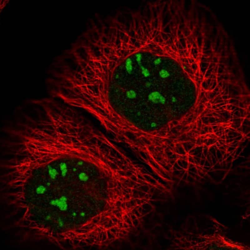 Immunocytochemistry/ Immunofluorescence RBM34 Antibody - BSA Free