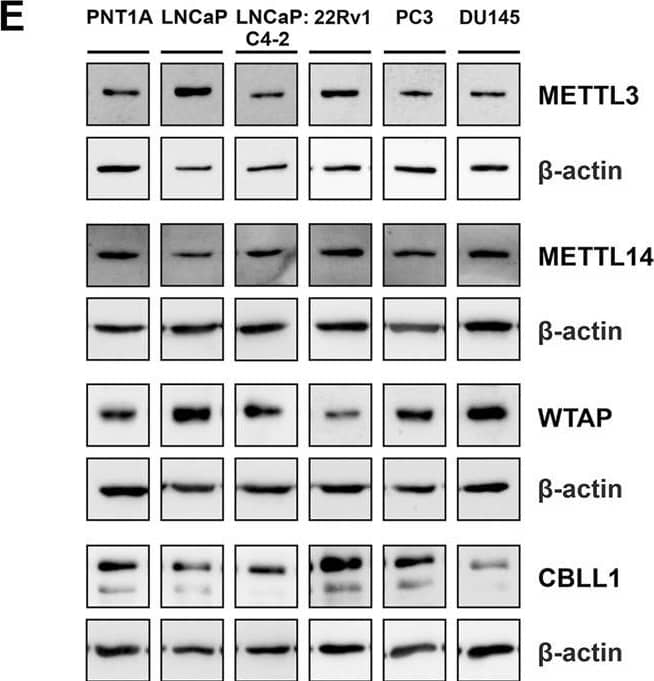METTL3, METTL14, WTAP and CBLL1 expression in non-malignant and prostate cancer cell lines; mRNA expression analysed by qRT-PCR relative to  beta -actin(A–D) and protein expression analysed using western blot (E). METTL3 protein expression as previously reported in Haigh et al. (2022). *p ≤ .05, **p ≤ .005, ***p ≤ .001, ****p ≤ .0001 by unpaired t-test. Image collected and cropped by CiteAb from the following open publication (//pubmed.ncbi.nlm.nih.gov/36733939), licensed under a CC-BY license. Not internally tested by Novus Biologicals.