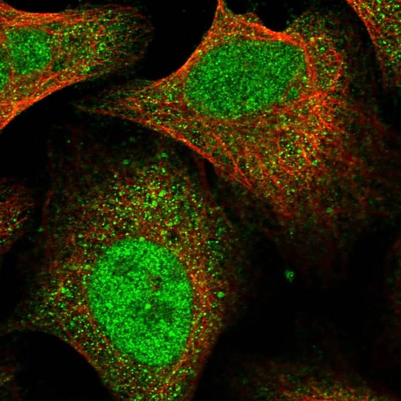 Immunocytochemistry/ Immunofluorescence FTSJD2 Antibody - BSA Free