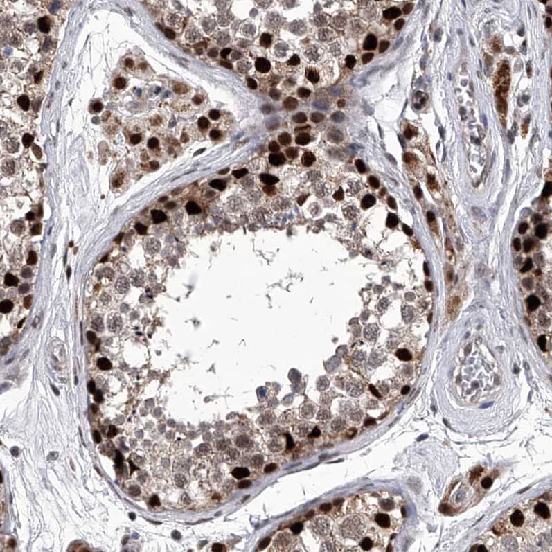 Staining of human testis shows strong nuclear positivity in cells in seminiferous ducts.