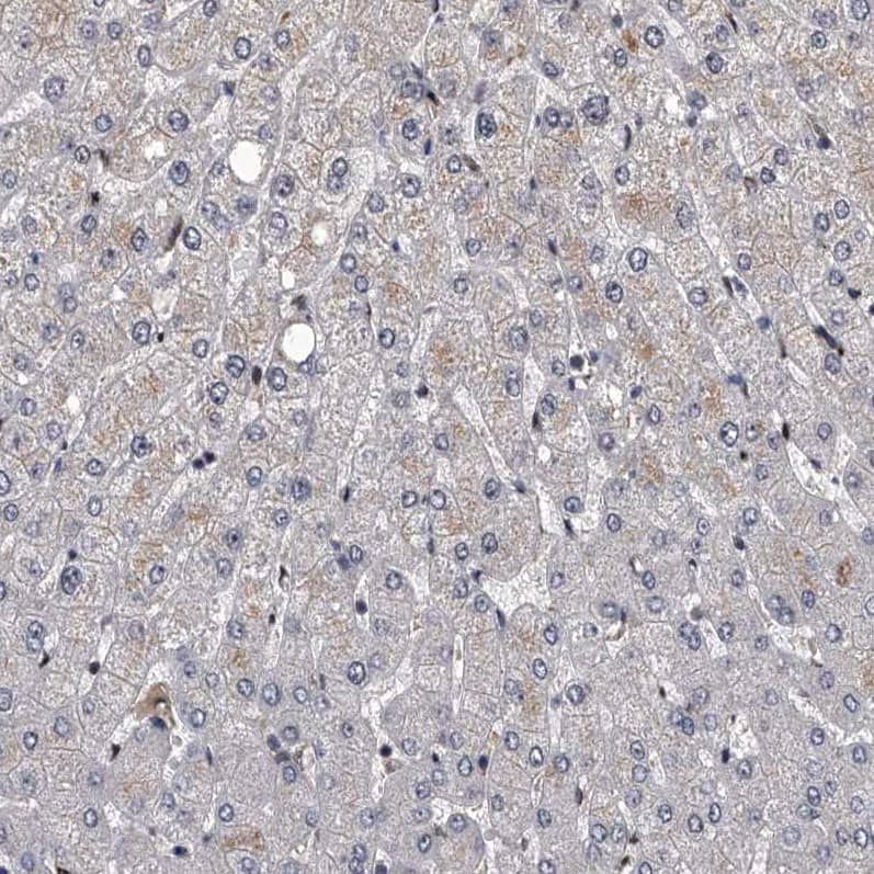 Staining of human liver shows no positivity in hepatocytes as expected.