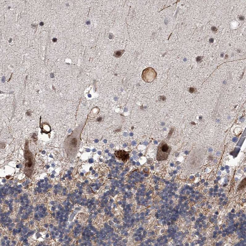 Staining of human cerebellum shows moderate to strong nuclear positivity in Purkinje cells.