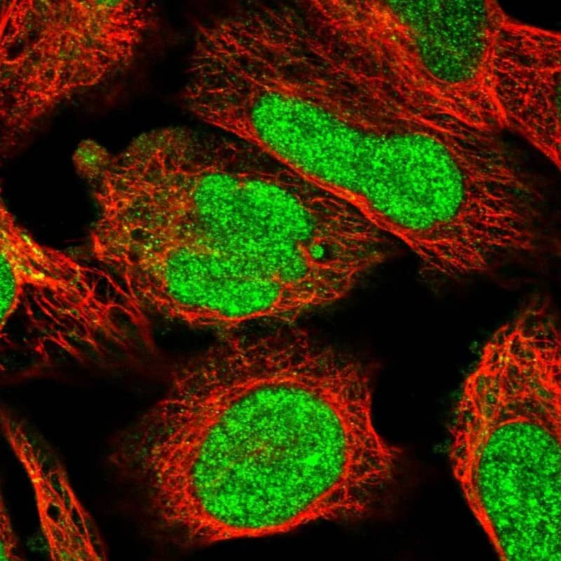 Immunocytochemistry/ Immunofluorescence FTSJD2 Antibody - BSA Free