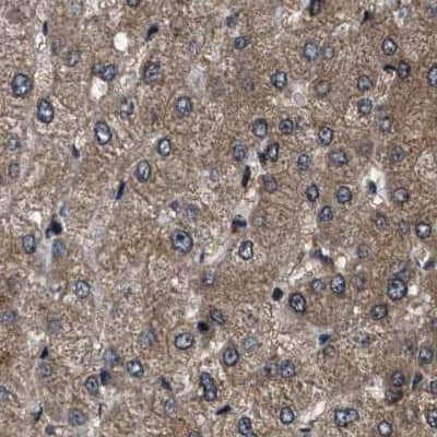 Staining of human liver.