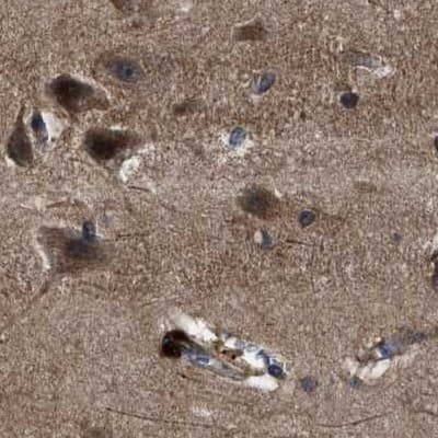 Staining of human cerebral cortex.