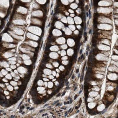 Staining of human colon.