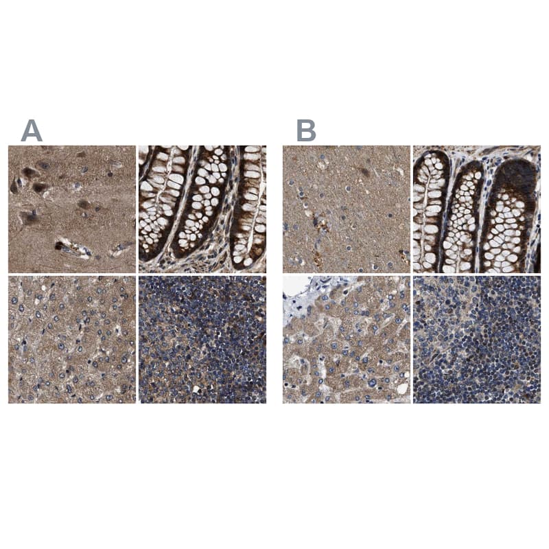 <b>Orthogonal Strategies Validation. </b>Staining of human cerebral cortex, colon, liver and lymph node HPA019353 (A) shows similar protein distribution across tissues to independent antibody HPA019360 (B).