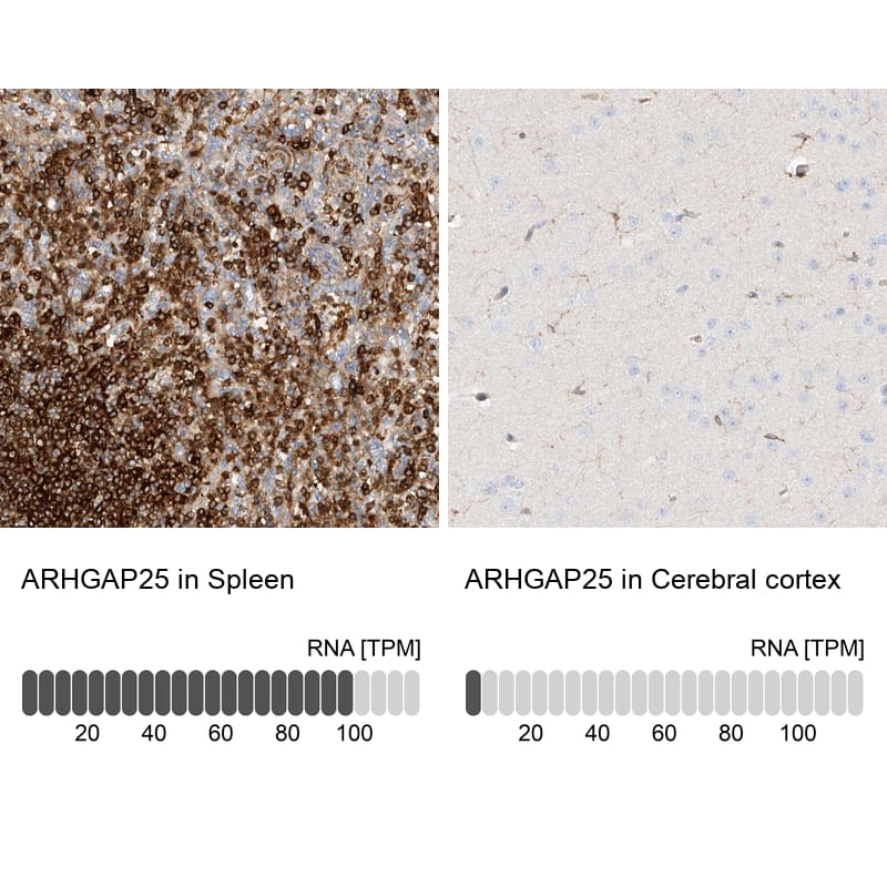 <b>Orthogonal Strategies Validation. </b>Analysis in human spleen and cerebral cortex tissues.