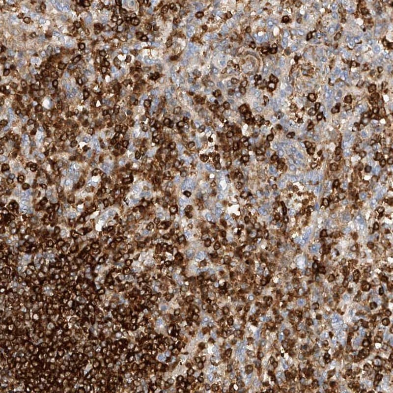 Staining of human spleen shows high expression.