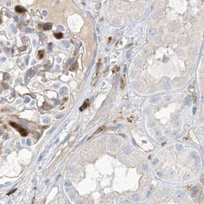 Staining of human kidney.