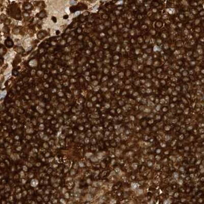 Staining of human lymph node.