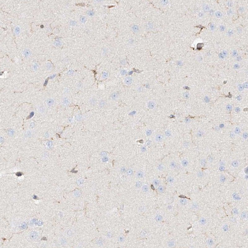 Staining of human cerebral cortex shows low expression as expected.