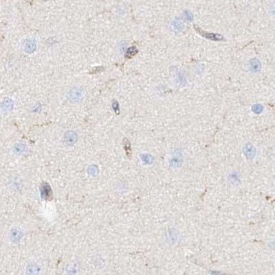 Staining of human cerebral cortex.