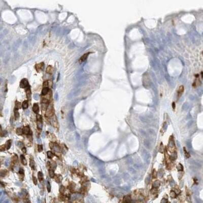 Staining of human colon.