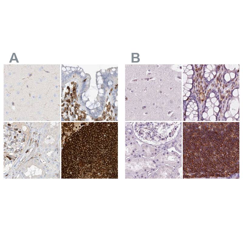 <b>Orthogonal Strategies Validation. </b>Staining of human cerebral cortex, colon, kidney and lymph node HPA035346 (A) shows similar protein distribution across tissues to independent antibody HPA061395 (B).