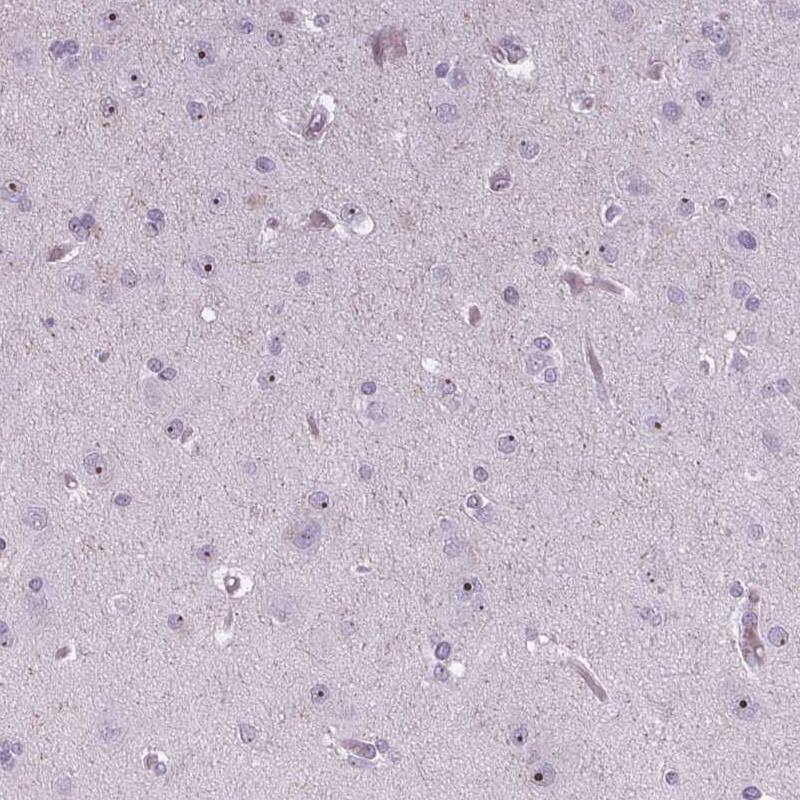 Staining of human cerebral cortex shows moderate nucleolar positivity in neuronal cells.
