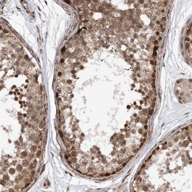 Immunohistochemistry-Paraffin DUSP22 Antibody - BSA Free