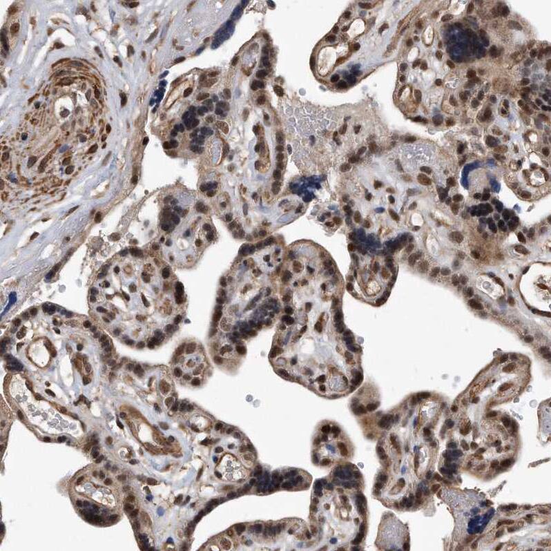 Staining of human placenta shows moderate to strong nuclear positivity in trophoblastic cells.