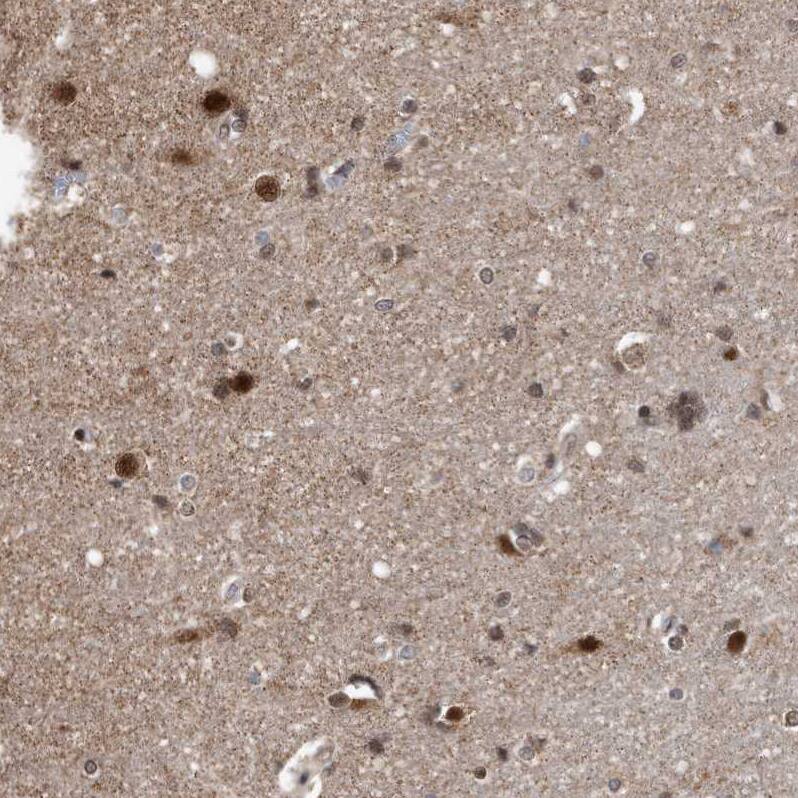 Staining of human cerebral cortex shows moderate to strong nuclear positivity in neurons.