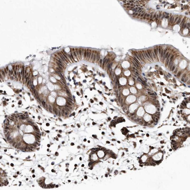 Staining of human colon shows moderate to strong cytoplasmic positivity in glandular cells.